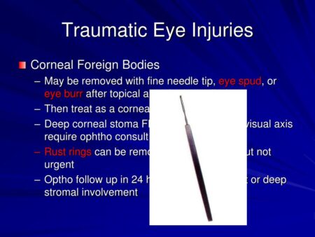 Sterling Questions Aspinall’s Eye Injury