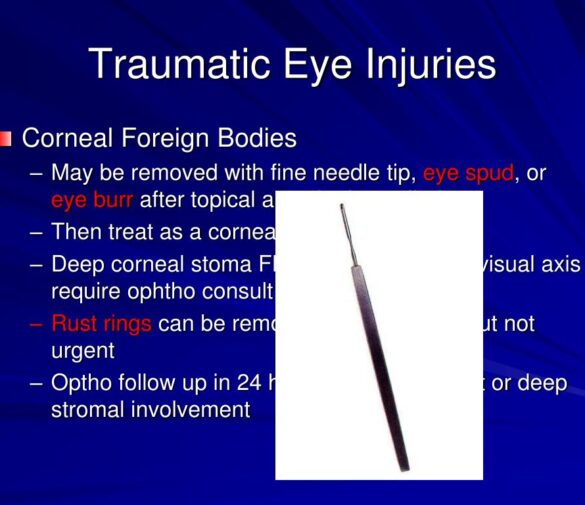 Sterling Questions Aspinall’s Eye Injury